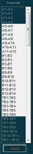 ../_images/interface_channel_sel.png