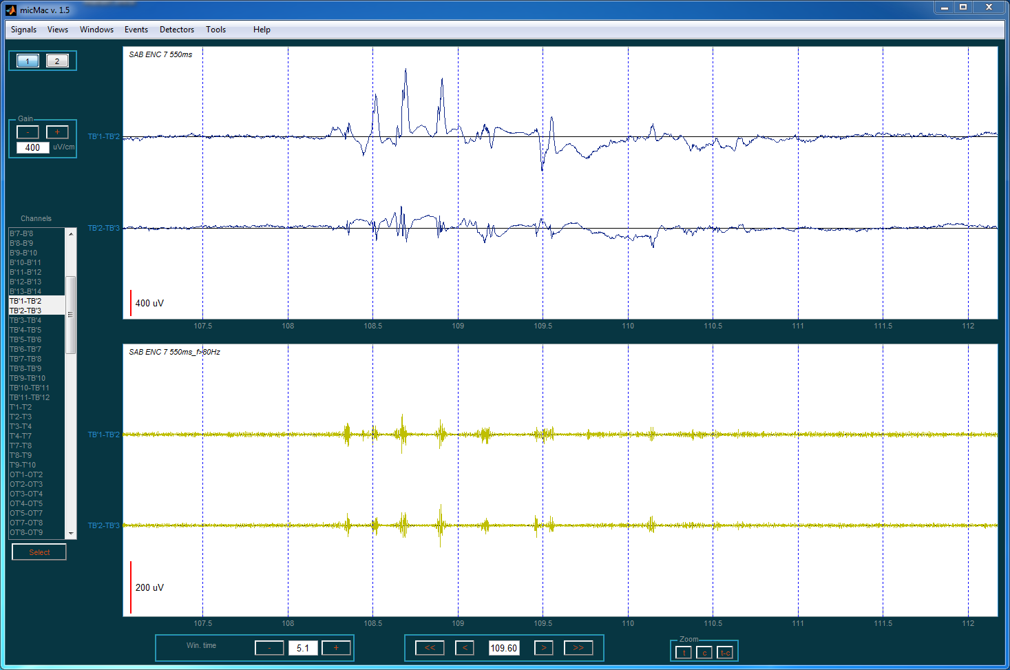 ../_images/interface_visu_mode_1_ex.png