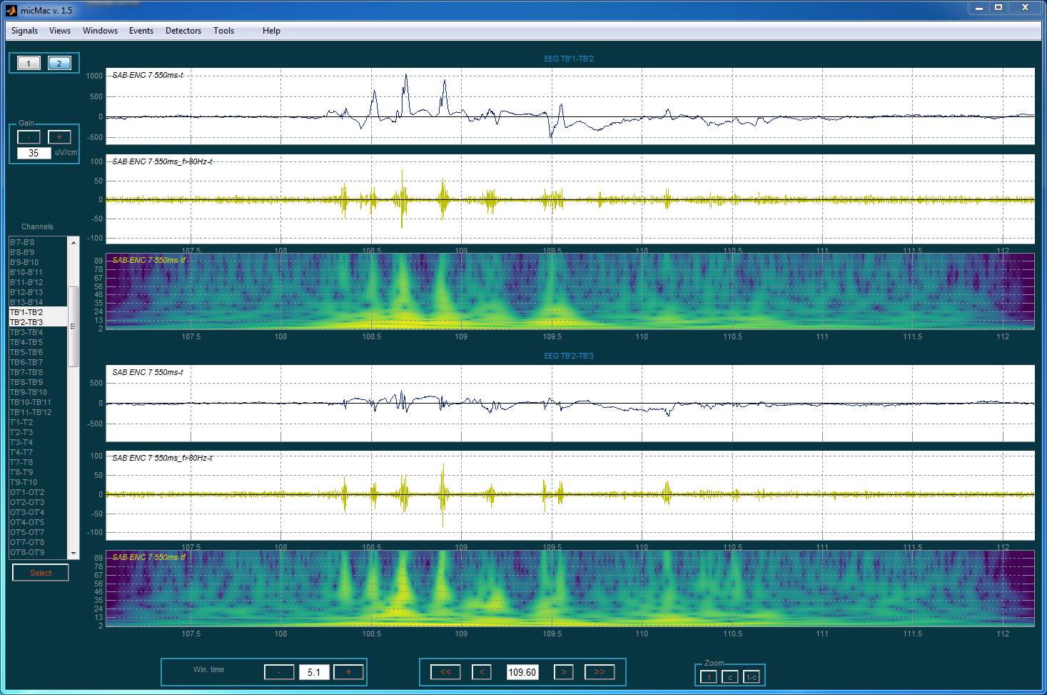 ../_images/interface_visu_mode_2_ex.png