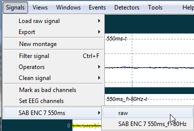 ../_images/signals_modify_signal_menu.png