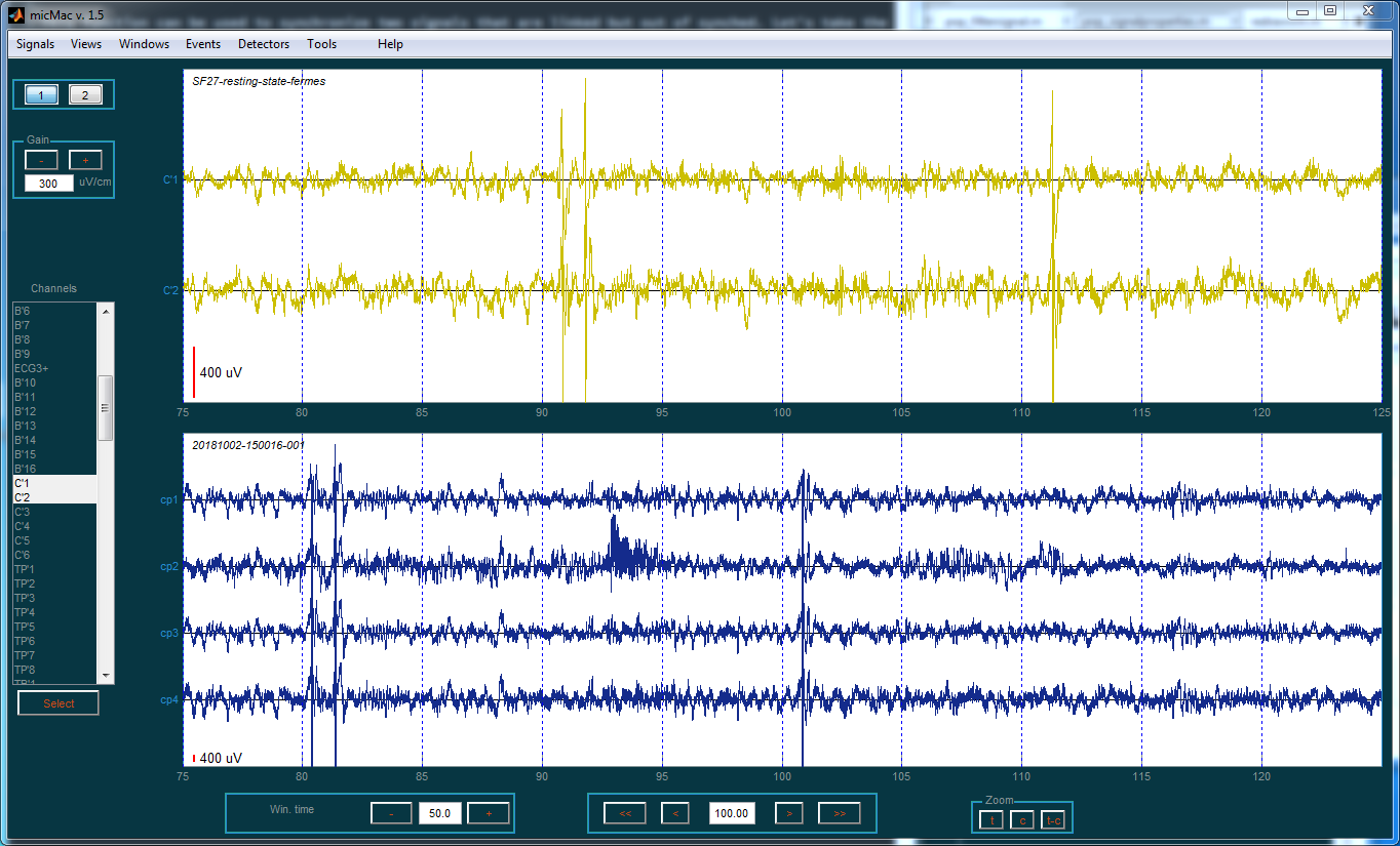 ../_images/signals_resynch_ex.png
