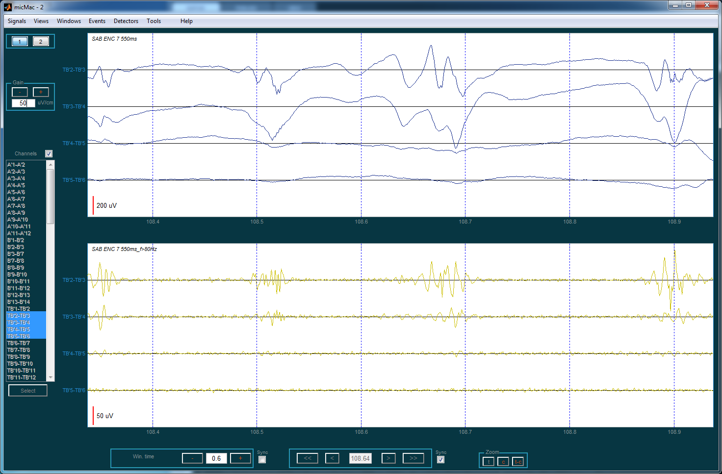 ../_images/windows_sync_syncwindow_time_2.png